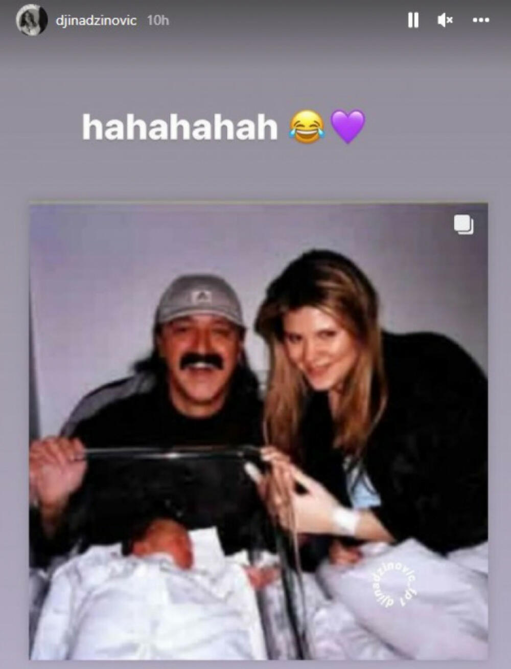 Melina je ranije imala višak kilograma