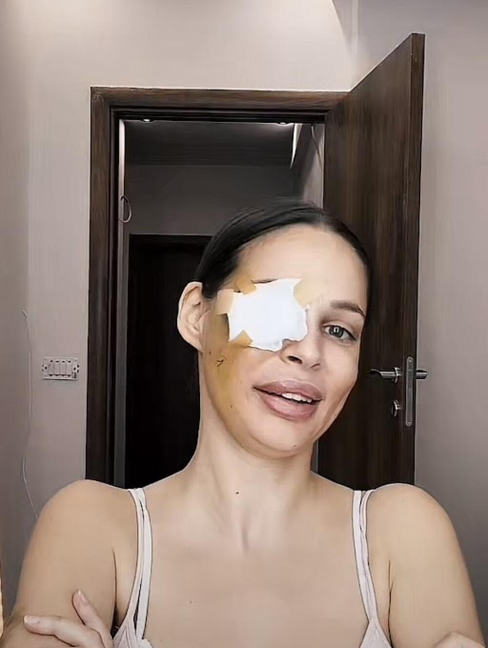  Nataša Šavija uključila se u lajv na društvenoj mreži Tiktok i pokazala kako izgleda nakon operacije