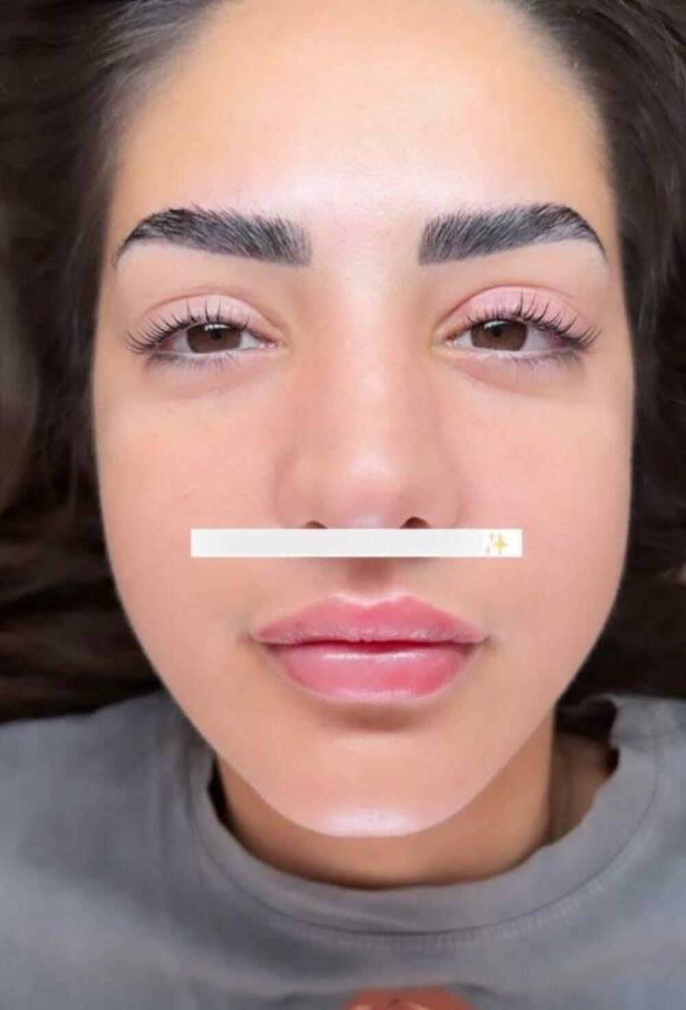 Promene na Licu Anđele Đuričić 