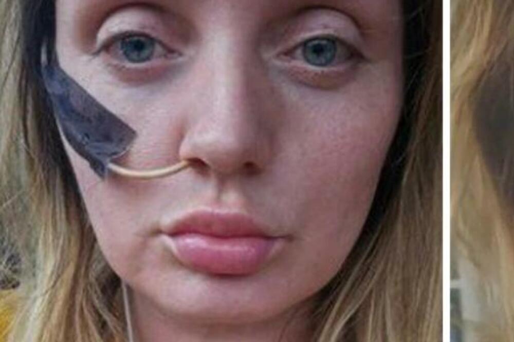 OTIŠLA JE DA OPERIŠE ŽELUDAC, A ONDA SE CEO ŽIVOT PRETVORIO U PAKAO: Nesrećnica je sad PRIKOVANA za krevet (VIDEO)