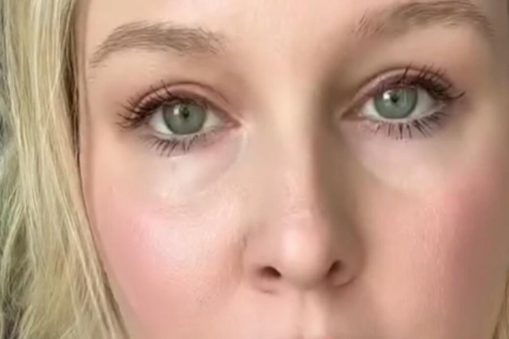 I DALJE SVAKI DAN JEDE ČIZBURGERE, A SMRŠALA JE 25 KILA ZA MANJE OD 8 MESECI: Svi se pitaju kako, sada je otkrila