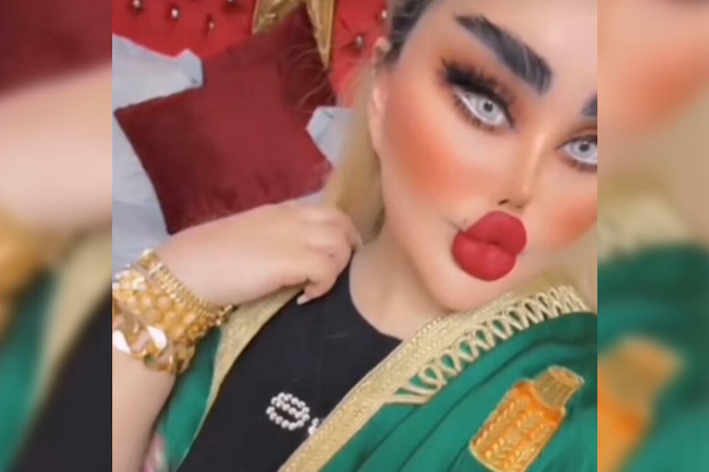 POZNATA VODITELJKA SE BUKVALNO UNAKAZILA, LJUDI SE SABLAZNE KAD JE VIDE: Posle ovoliko operacija i vi ćete (VIDEO)