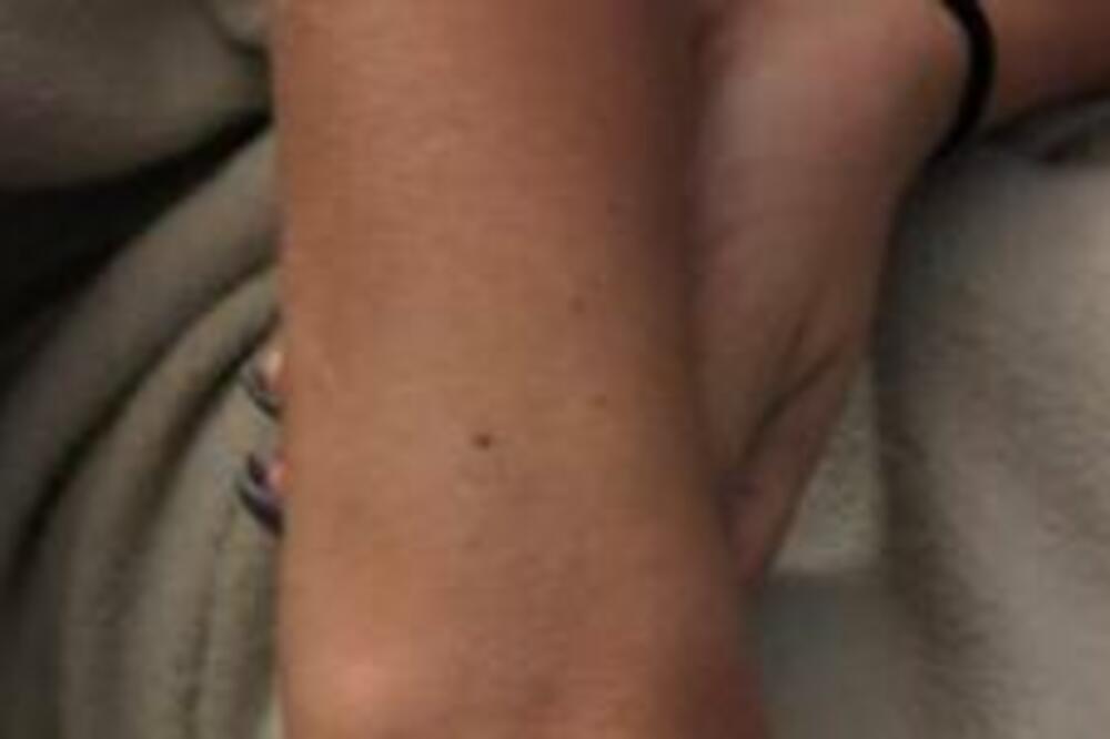 AKO IMATE MLADEŽ NA OVOM DELU TELA, OVO JE RAZLOG: Dermatolog otkrio PRAVU ISTINU o njemu, zanemećete