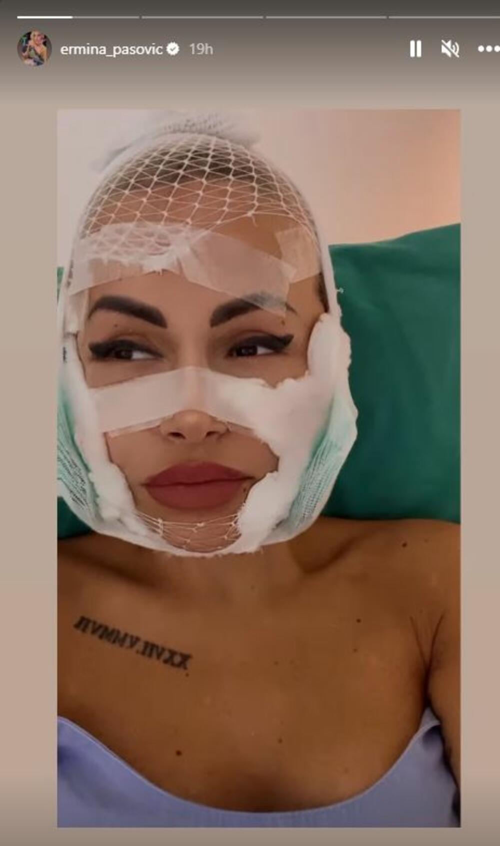 Ermina Pašović nakon operacije