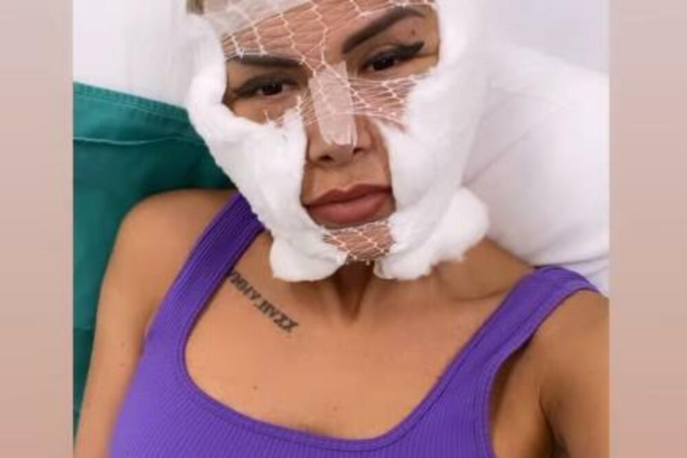 ERMINA PAŠOVIĆ NAKON OPERACIJE: Sva u ZAVOJIMA, jedva USPELA da IZGOVORI OVE REČI, evo šta je PONOVO radila na SEBI