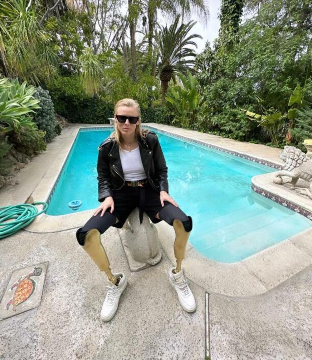 Loren Vaser sa amputiranim nogama