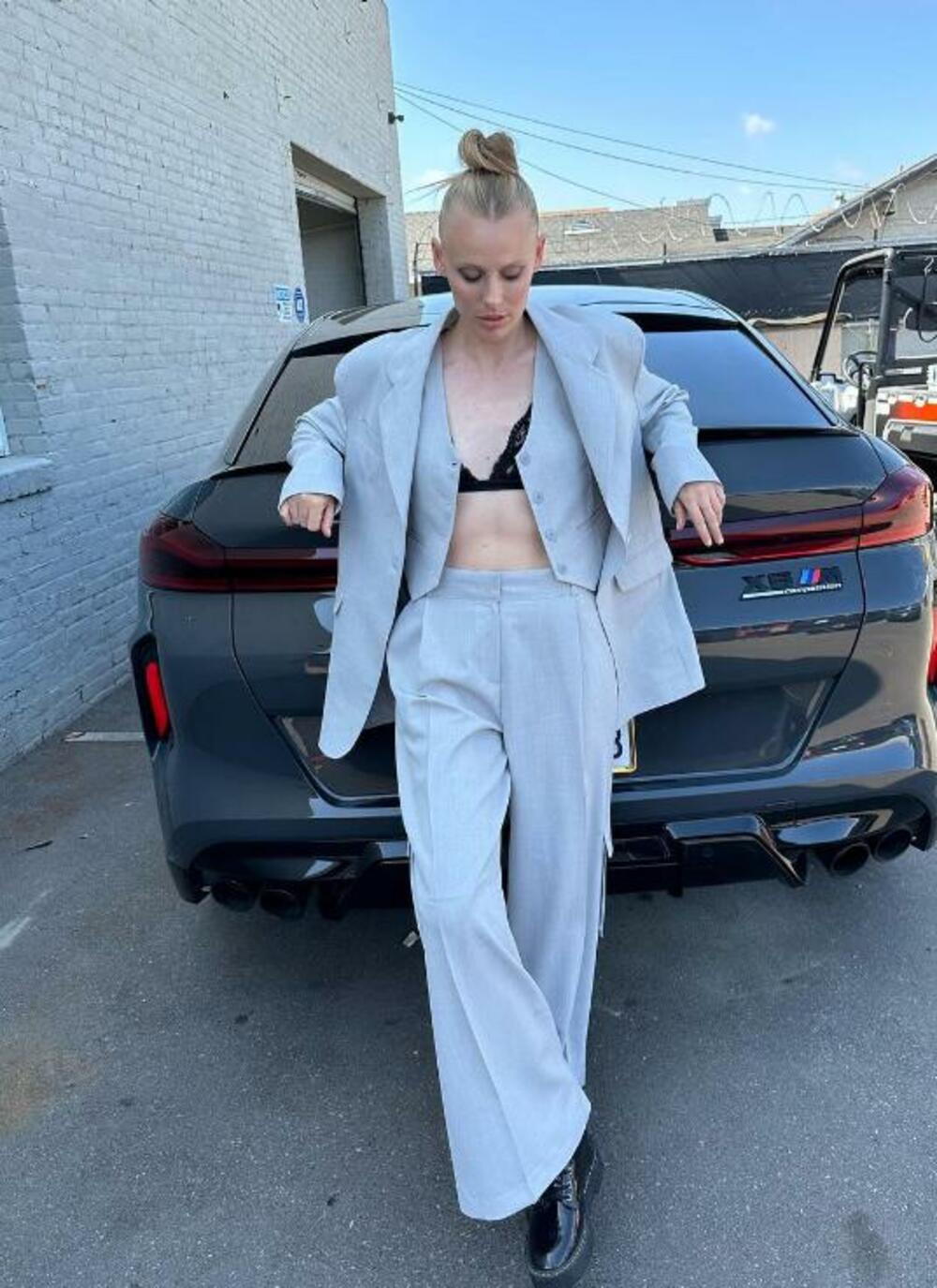 Imala je STŠ (Sindrom toksičnog šoka)