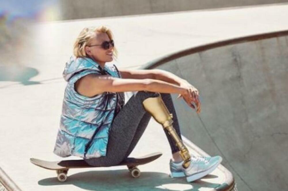 MANEKENKI AMPUTIRALI OBE NOGE ZBOG TAMPONA! Osećala se kao da ima GRIP, a onda se desio NAJSTRAŠNIJI SCENARIO