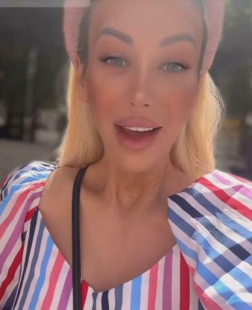 Prvo pojavljivanje nakon intervencija i skidanja zavoja