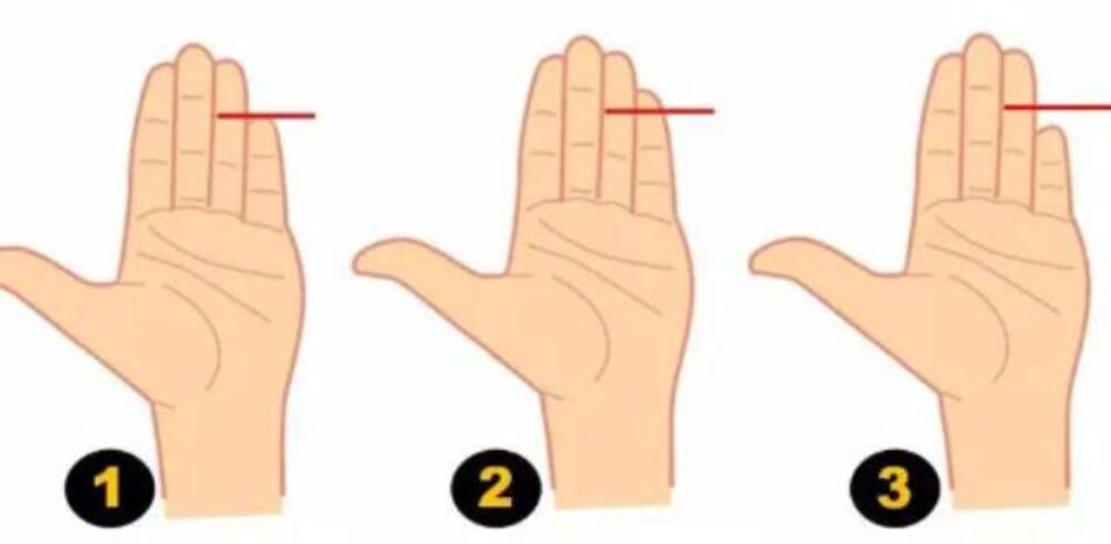 Rika, Šaka, Dlan, Prst, Prsti