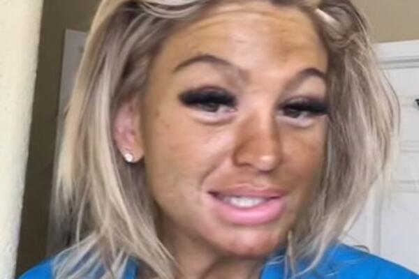 ZASPALA SA KREMOM ZA TEN NA LICU, PA NIJE MOGLA SEBE DA PREPOZNA: Kad se pogledala ujutru u ogledalo, zaplakala je