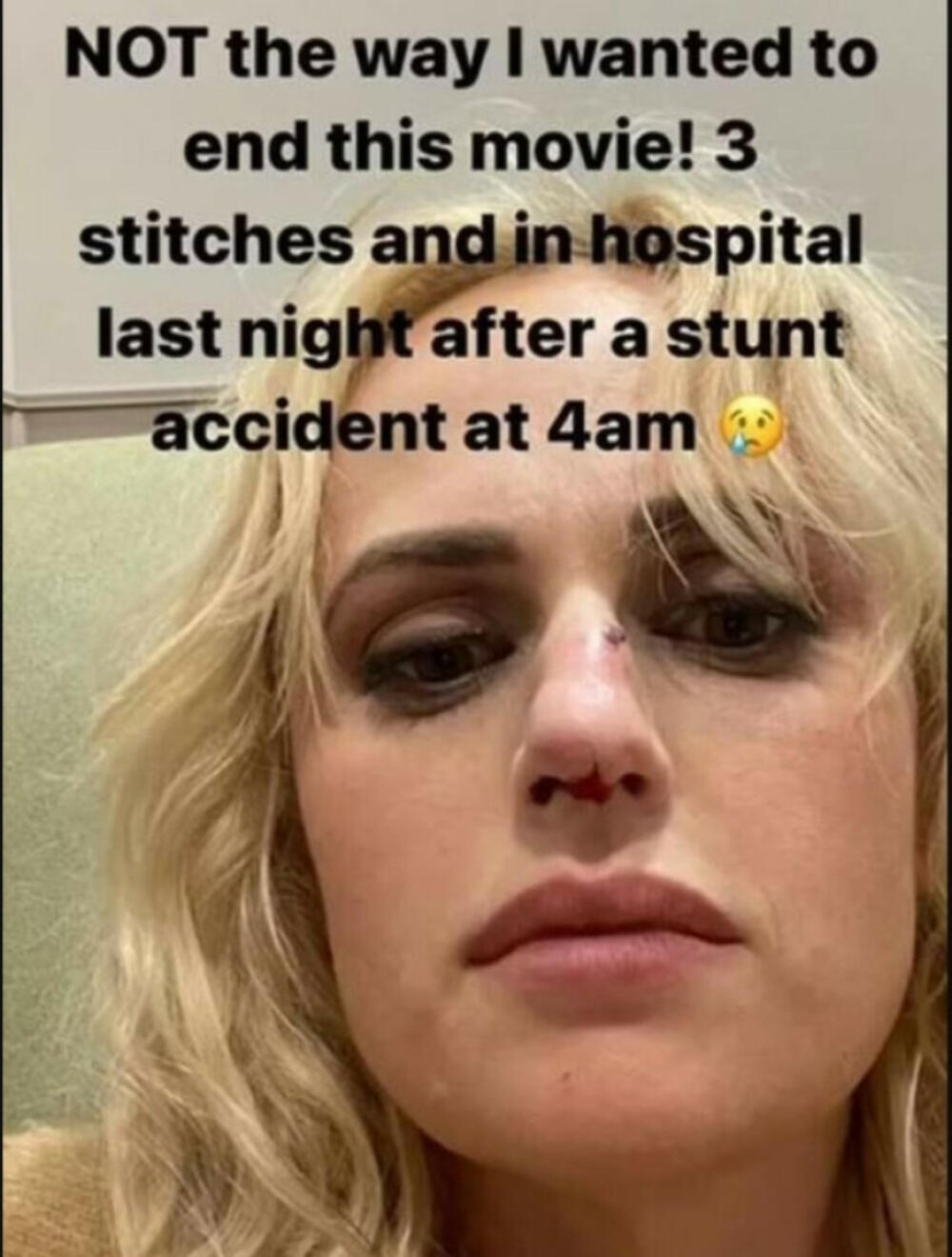 Rebel radi na novom filmu 'Bride Hard' gde se i dogodila nezgoda.