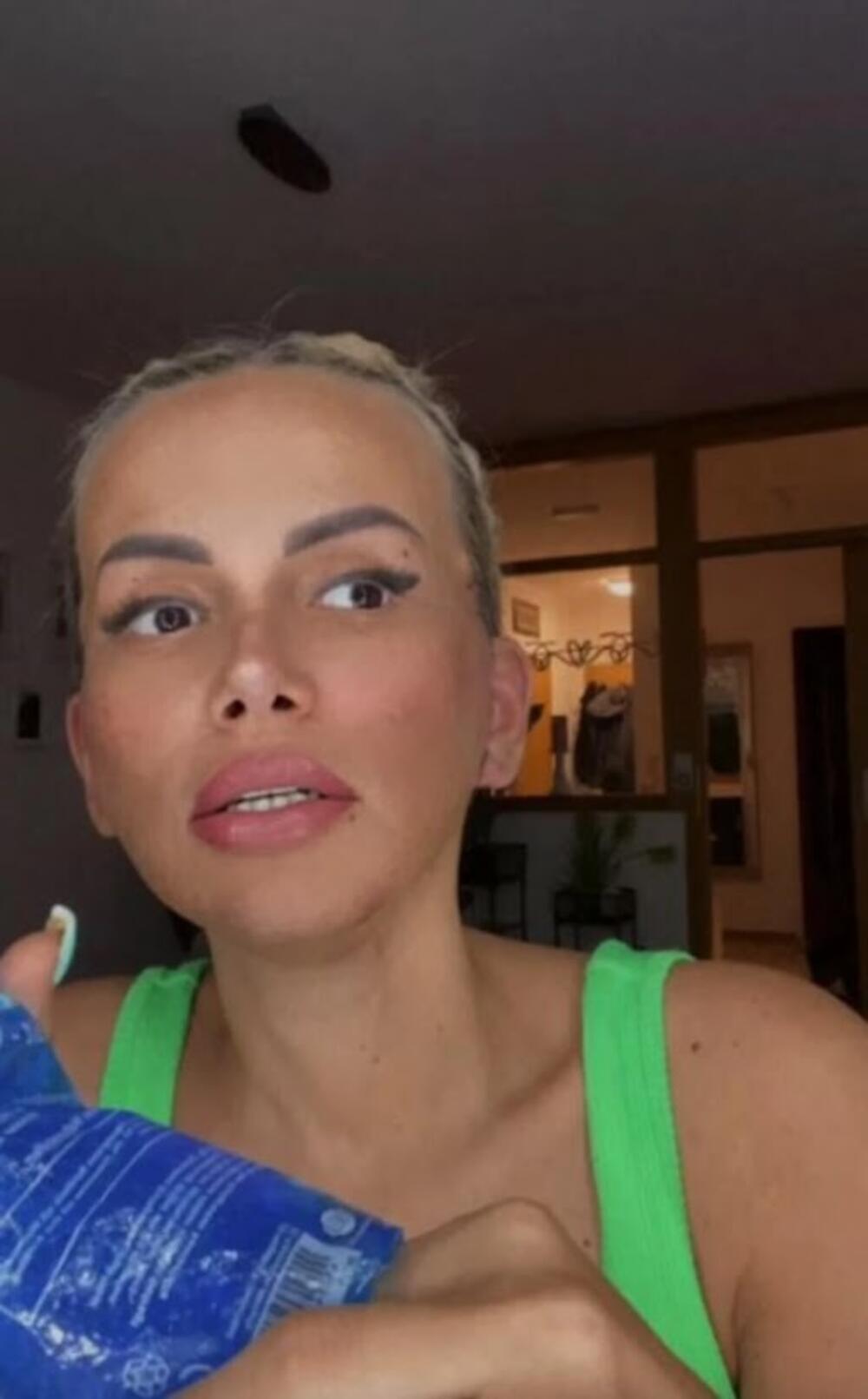 Ermina se operisala i skinula zavoje