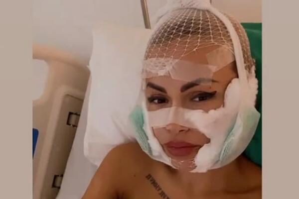 ZADRUGARKA SKINULA ZAVOJE NAKON OPERACIJE I POKAZALA LICE: Evo kako sada IZGLEDA, mnogi komentarišu JEDNO