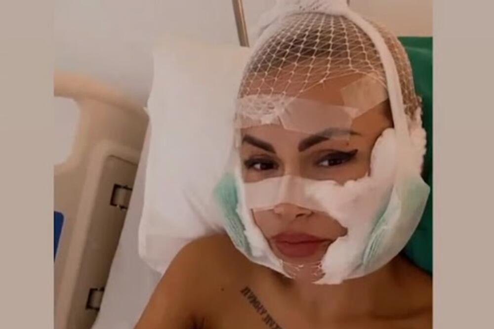 ZADRUGARKA SKINULA ZAVOJE NAKON OPERACIJE I POKAZALA LICE: Evo kako sada IZGLEDA, mnogi komentarišu JEDNO