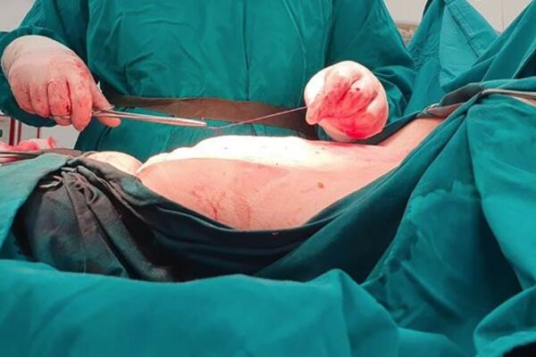 DOKTOR IZ PROKUPLJA ODSEKAO ŠAKU PACIJENTU, PA ZAVRŠILI NA SUDU: Evo šta je utvrđeno