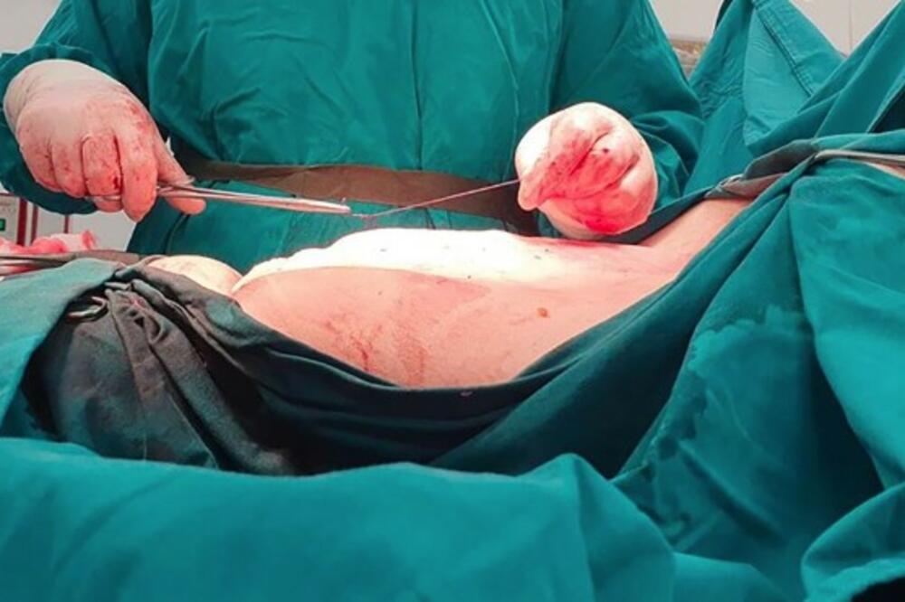 DOKTOR IZ PROKUPLJA ODSEKAO ŠAKU PACIJENTU, PA ZAVRŠILI NA SUDU: Evo šta je utvrđeno