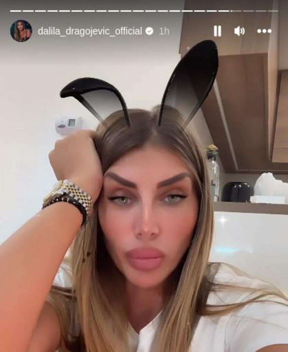 Dalila Dragojević se žalila pratiocima na problem