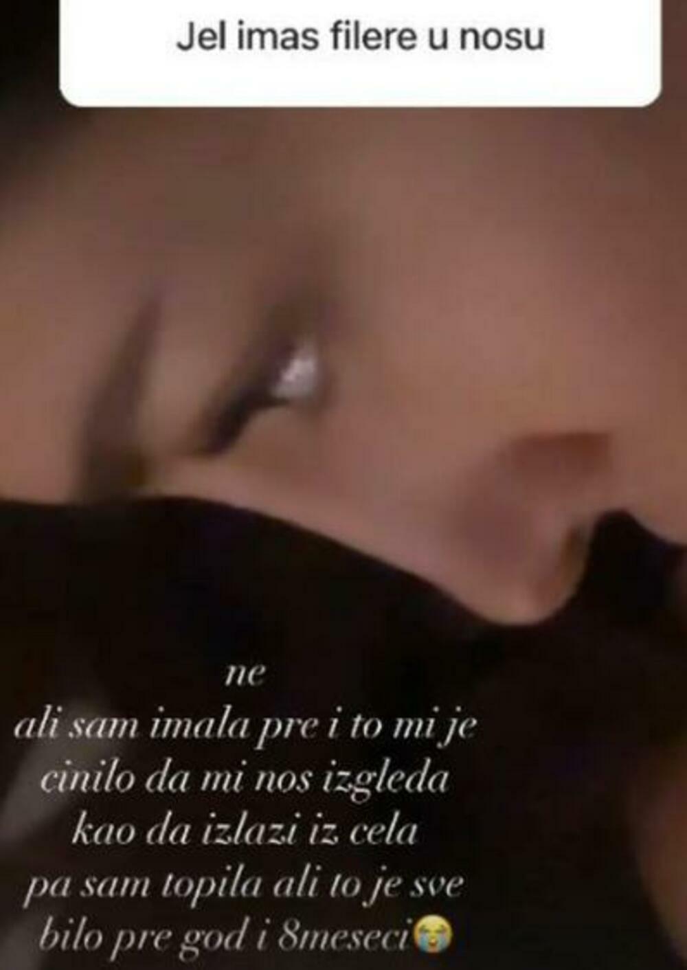 Đina Džinović o filerima u nosu