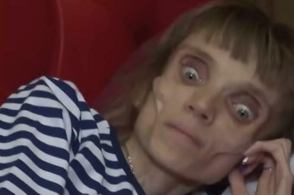 KRISTINA JE BILA STUDENT GENERACIJE, A ONDA JE SPALA NA 17 KILOGRAMA: Ovo je njena životna borba!