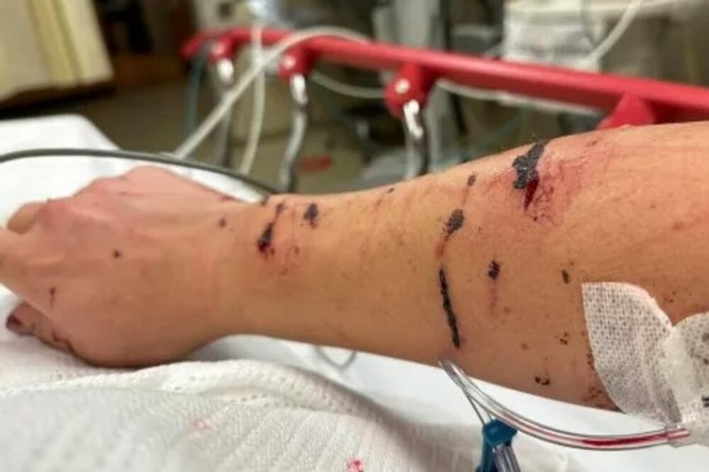 OVO JE SITUACIJHA KAD ĆE VAS DOBERMAN RASTRGNUTI: Mnogi se igraju sa njim, a ni ne slute koliko je OPASAN (FOTO)