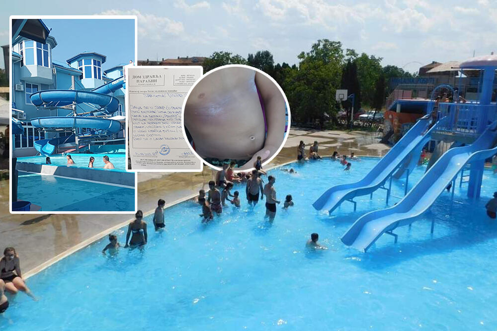 "MLAĐI SIN JE BIO U ŽIVIM RANAMA SVUDA PO TELU": Deca sa bazena u Paraćinu došla ISKASAPLJENA, jaukala OD BOLOVA!