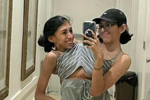 INTIMNI ŽIVOT OVIH SIJAMSKIH BLIZNAKINJA ĆE VAS ŠOKIRATI: Progovorile o FETIŠIMA, evo šta OBE rade sa DEČKOM (FOTO)