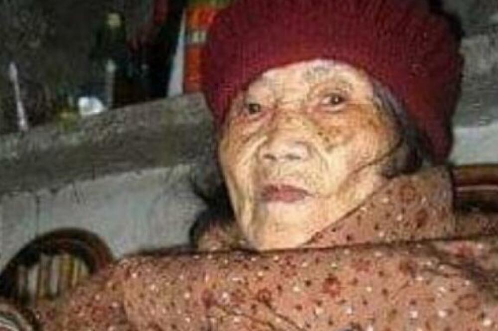 NEVEROVATNA PRIČA IZ 1948.: Kineskinja (92) trpela BOLOVE U STOMAKU, pa posle POLA VEKA otkrila BIZARNU STVAR