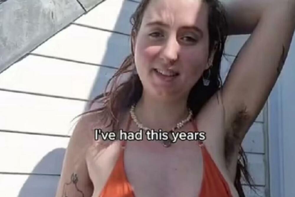 SLIKALA SE U BIKINIJU I SVI SU SE ZGROZILI, EVO KAKO IZGLEDA TAMO DOLE: Devojka se NE DEPILIRA i voli svoje DLAKE