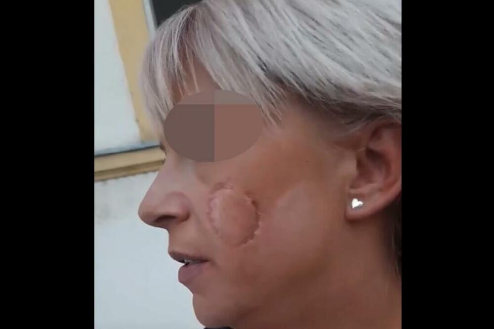 NA SNIMKU SE ČUJE JEZIVA REČENICA KOJU NASILNIK IZGOVARA BIVŠOJ ŽENI: Udario je, UJEO za obraz, pa izgovorio TO