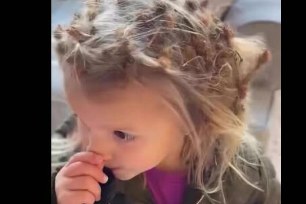 DEVOJČICA SE IGRALA NAPOLJU, A ONDA JE MAMA UGLEDALA NJENU FIRZURU: Od prizora je VRISNULA, malena NIJE SVESNA...