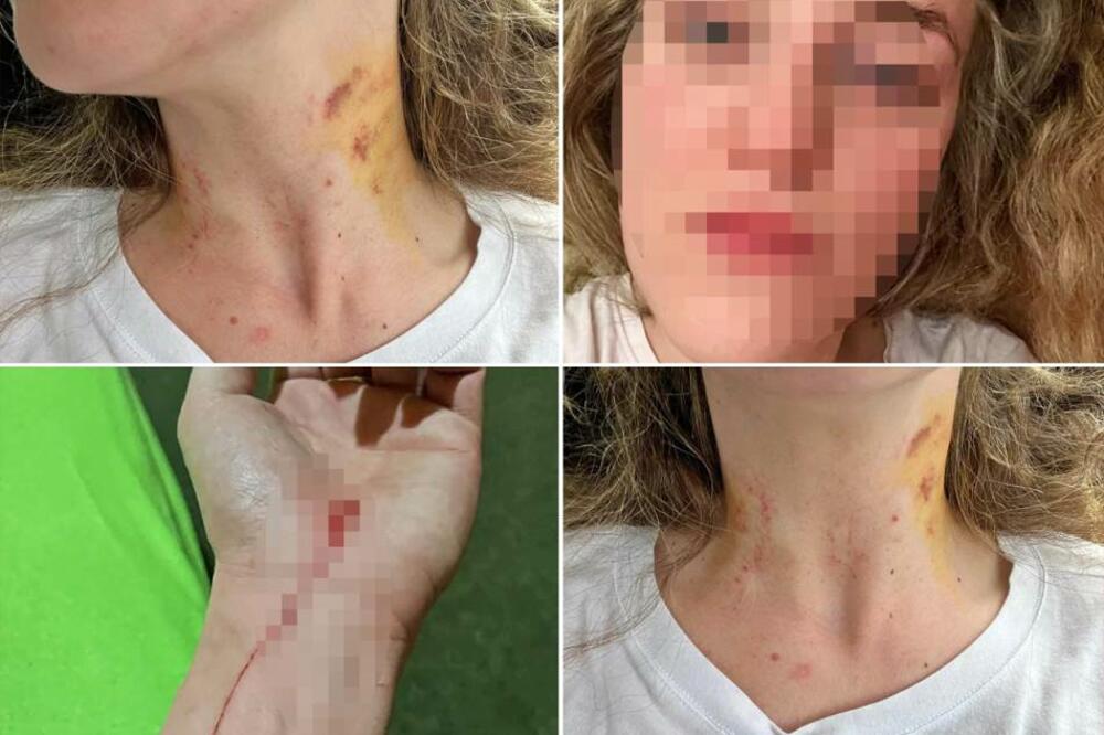 "ZNAMO DA ĆEŠ SPAVATI SA PSIHOLOGOM"! Nada preživela PAKAO sa bivšim partnerom, lomio joj REBRA i DAVIO JE (FOTO)