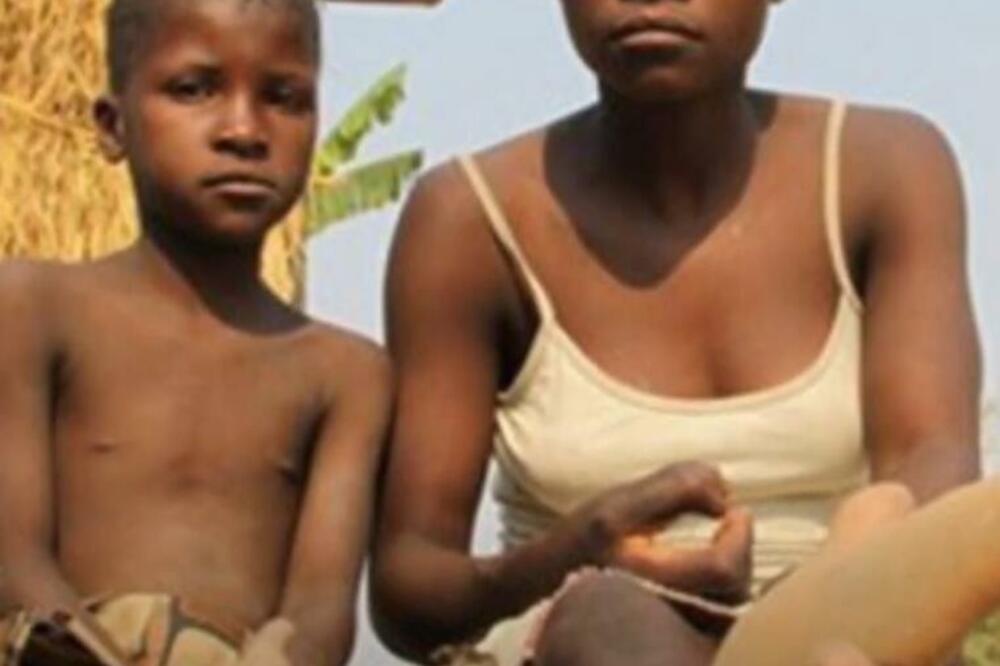 O OVOM PLEMENU SVI BRUJE, RAĐAJU SE SA MUTACIJAMA: Svako 4. DETE izgleda OVAKO, zovu ih i BIZARNIM imenom (VIDEO)