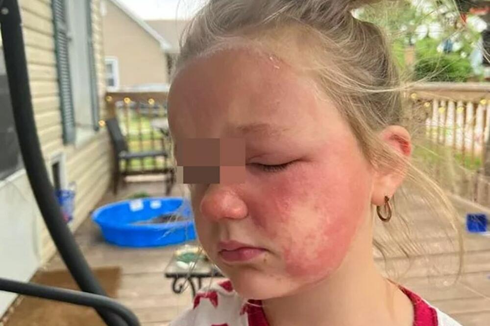 ISPOVEST MAJKE ČIJA SE ĆERKA OTROVALA: Pazite, ova biljka može biti i u vašem dvorištu