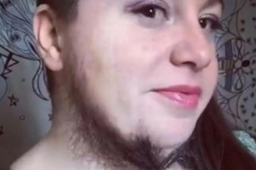 NA PRVI POGLED DELUJE SASVIM NOMALNO, DOK NE POKAŽE DONJI DEO LICA: Visi jos duž vrata i OGROMNA JE (FOTO)