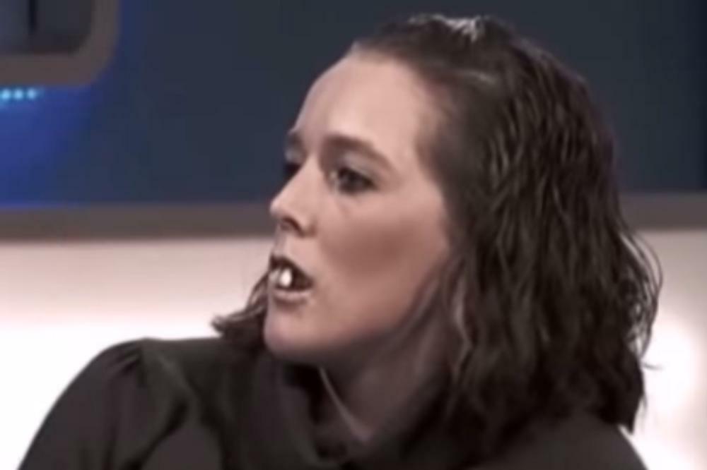 ZVALI SU JE "ŽENA SA KONJSKIM ZUBIMA": Sada izgleda TOTALNO DRUGAČIJE, kakva TRANSFORMACIJA! (FOTO)