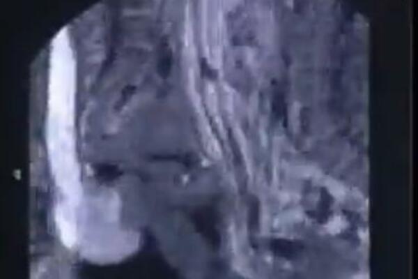IMALI SU SE*S U MAGNETNOJ REZONANCI, A SAD JE OBJAVLJEN I SNIMAK: Sve se VIDI, gledaćete u ČISTOJ NEVERICI (VIDEO)