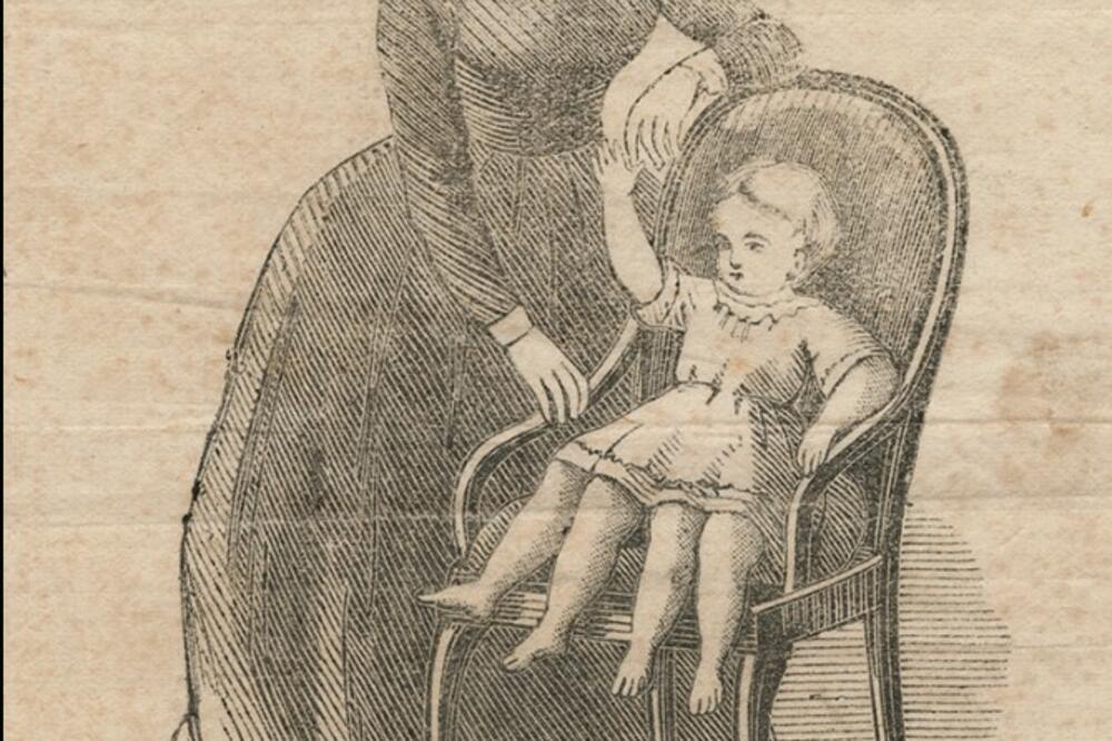 DEVOJČICA ROĐENA SA 2 KARLICE, 4 NOGE I 2 POLNA ORGANA OSTAĆE VEČNO UPAMĆENA: Njen život će vas ostaviti BEZ DAHA