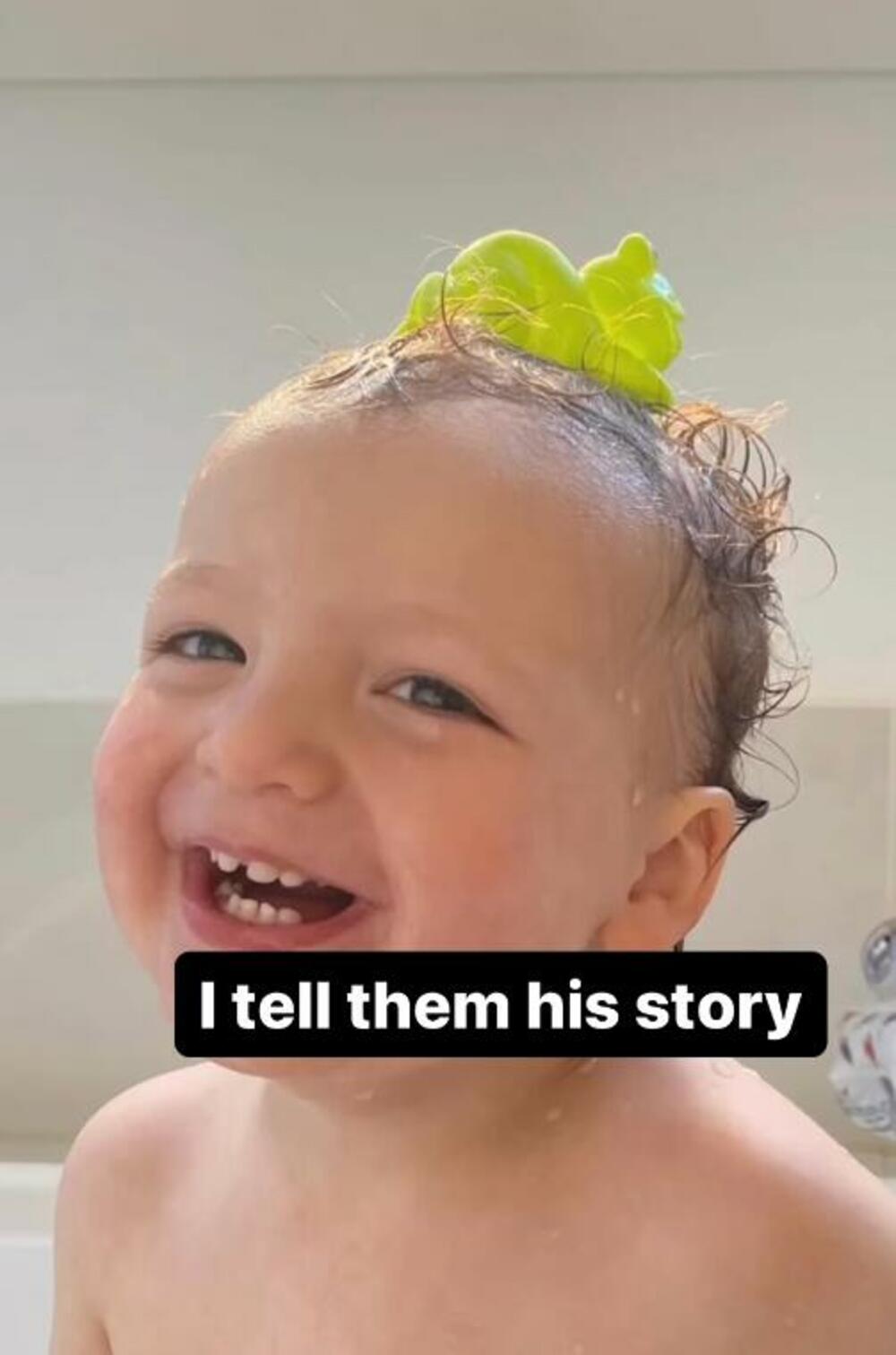 Dete koje je progutalo čep