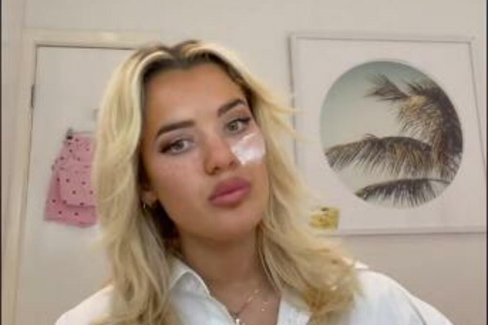 ZBOG OPASNOG TRENDA KOJI SE ŠIRI INTERNETOM SEBI JE UNIŠTILA LICE: Jezivo se UPROPASTILA za samo 7 dana (VIDEO)