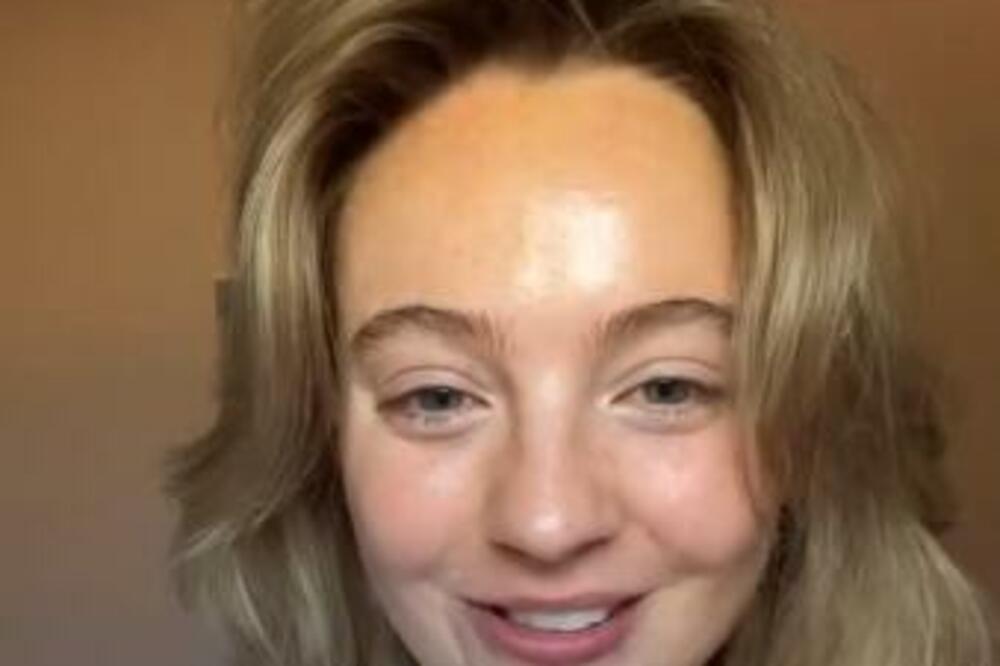 TIKTOKERKA OTKRILA, A DOKTORKA ODOBIRILA: Stavila je OVO na kosu i tako se rešila MASNOĆE i PERUTI zauvek (VIDEO)