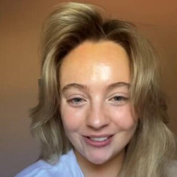 TIKTOKERKA OTKRILA, A DOKTORKA ODOBIRILA: Stavila je OVO na kosu i tako se rešila MASNOĆE i PERUTI zauvek (VIDEO)