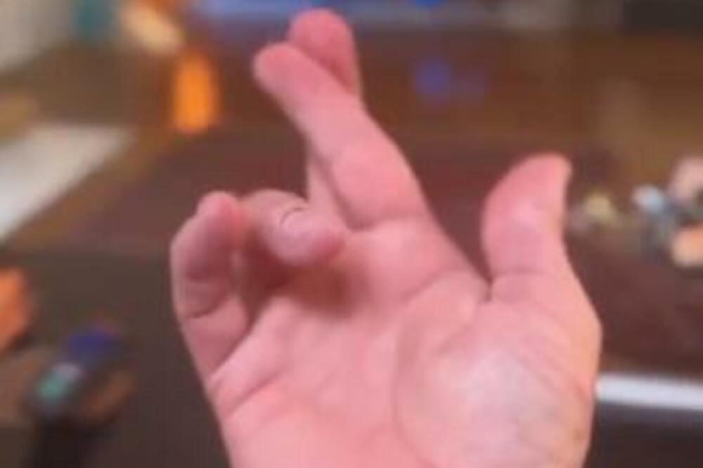 OTKRIJTE KAKO VAM RADI MOZAK UZ POMOĆ OVOG TESTA OD 3 SEKUNDE: Ako ga PADNETE, to je LOŠ ZNAK