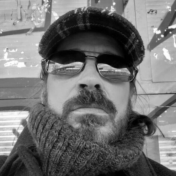 ZBOG ZRAČENJA MU OSTALA ZADEBLJANJA I OTEKLINE! Imao rak glave i vrata, pa zbog bolesti spao na 35 kila