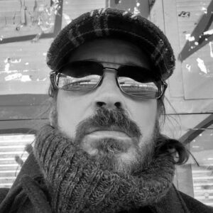 ZBOG ZRAČENJA MU OSTALA ZADEBLJANJA I OTEKLINE! Imao rak glave i vrata, pa zbog bolesti spao na 35 kila