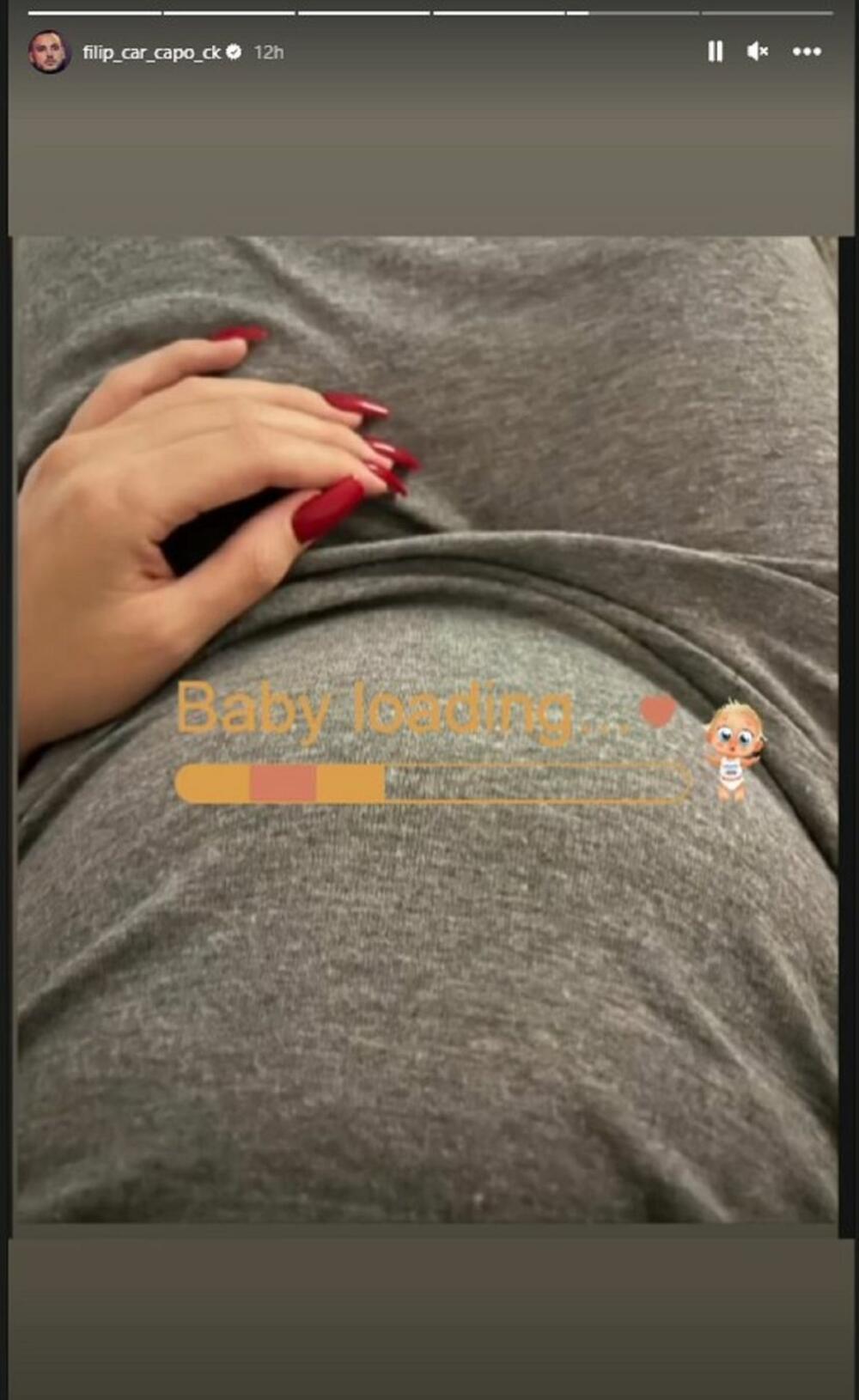 Filip Car objavio fotogorafiju Aleksandrinog stomaka