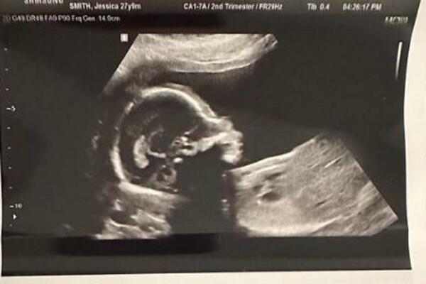 OTIŠAO SA DEVOJKOM NA PREGLED, ONO ŠTO JE VIDEO NA EKRANU NIKAD NEĆE ZABORAVITI: Datum sa snimka mu je SVE otkiro