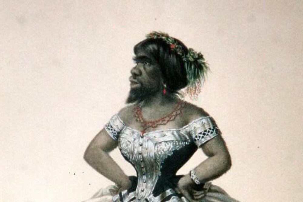 TRAGEDIJA "ŽENE MAJMUNA": Jedini SREĆAN trenutak njenog života se pretvorio u PAKAO, ni posle SMRTI nije našla MIR!