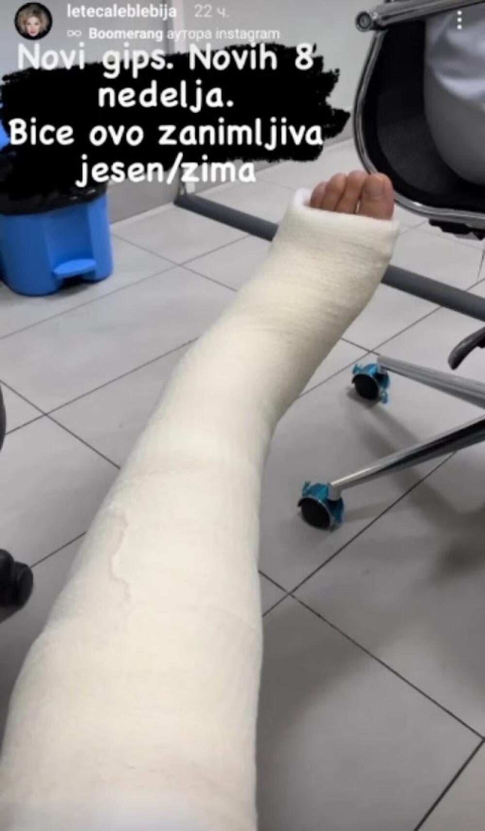 Glumica Aleksandra Janković završila je u gipsu nakon teške povrede koju je imala