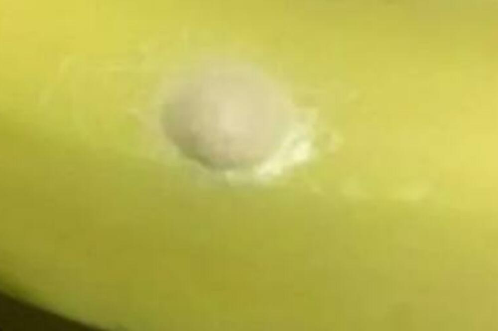 KUPILA BANANE SA BELIM TAČKAMA, PA SAZNALA JEZIVU ISTINU: Nije čekala ni sekunde, odmah ih je BACILA U KONTEJNER